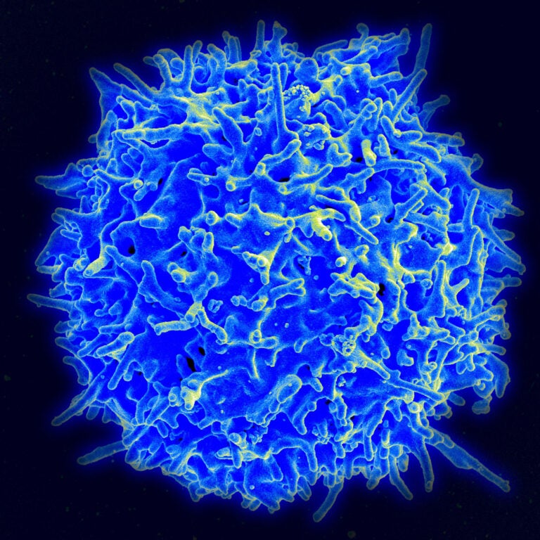 electron micrograph image of a human t-cell