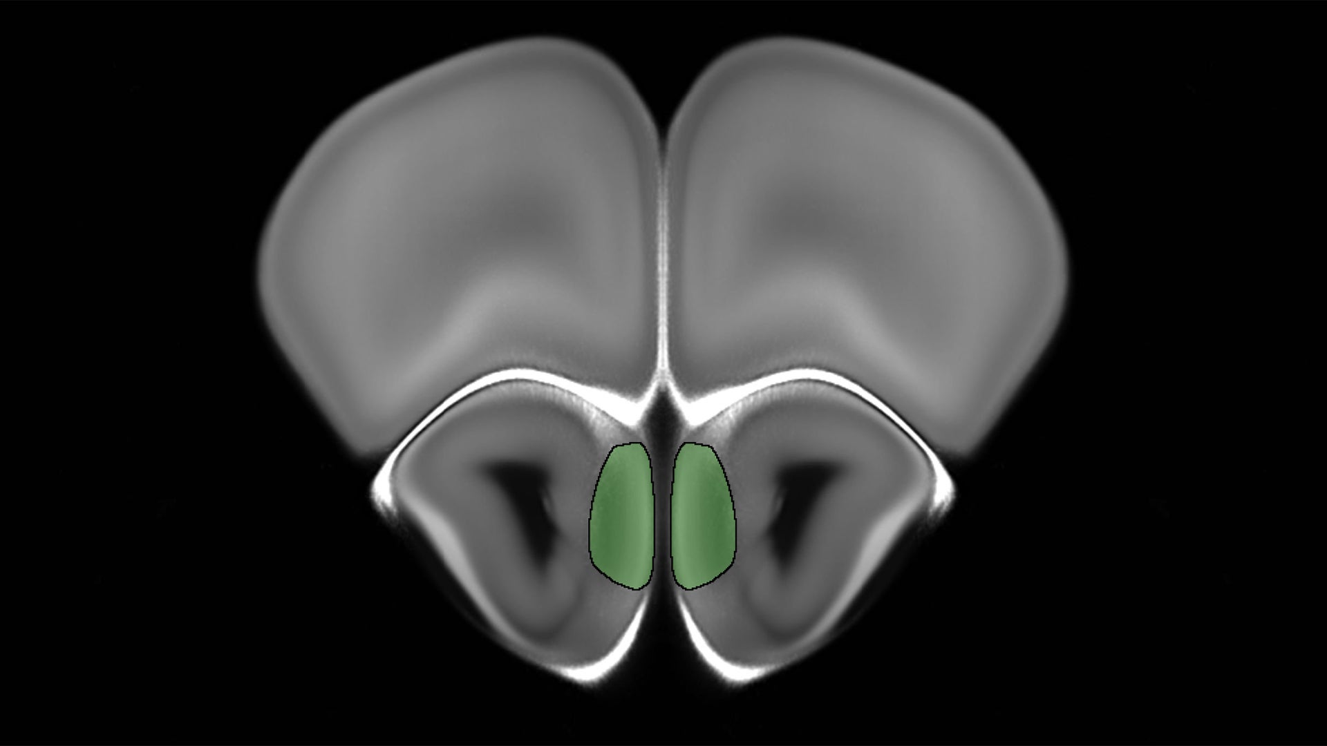 electron microscopic image of a mouse brain odor processing center