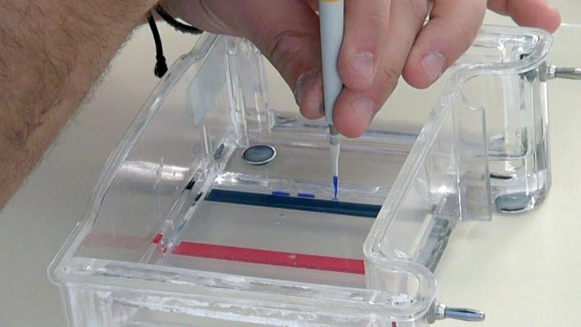 photograph of gel electrophoresis