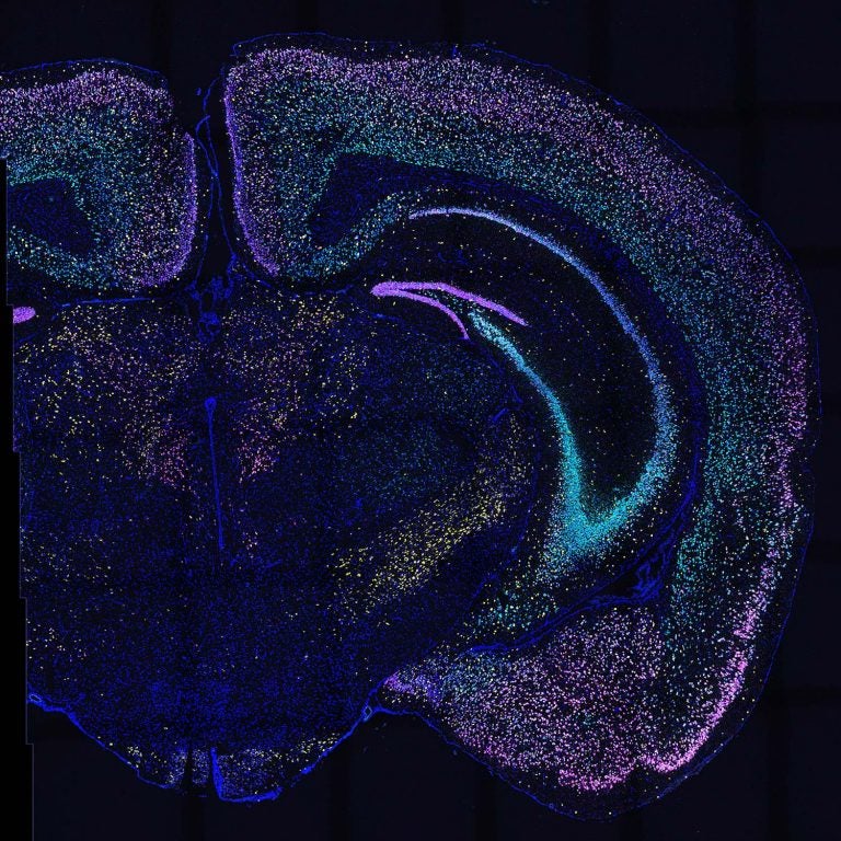 image of mouse brain slice