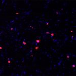 photo of SARS infected human lung cells