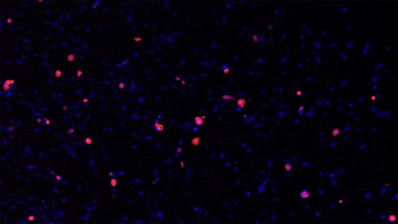 photo of SARS infected human lung cells