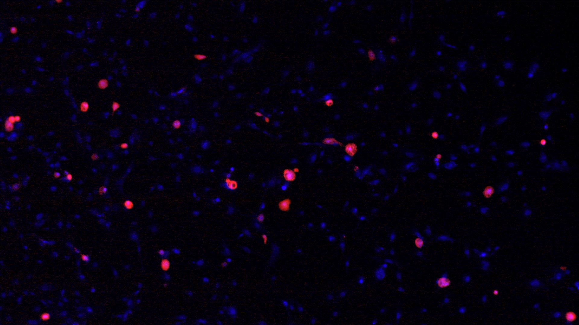 photo of SARS infected human lung cells