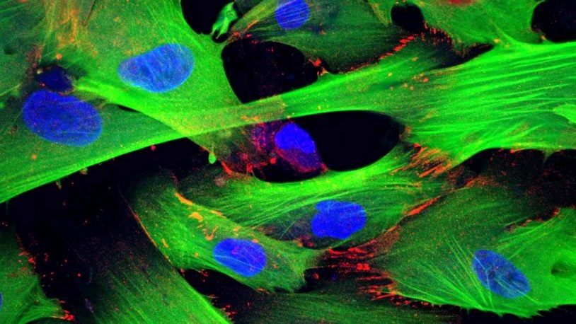 image of fibroblasts