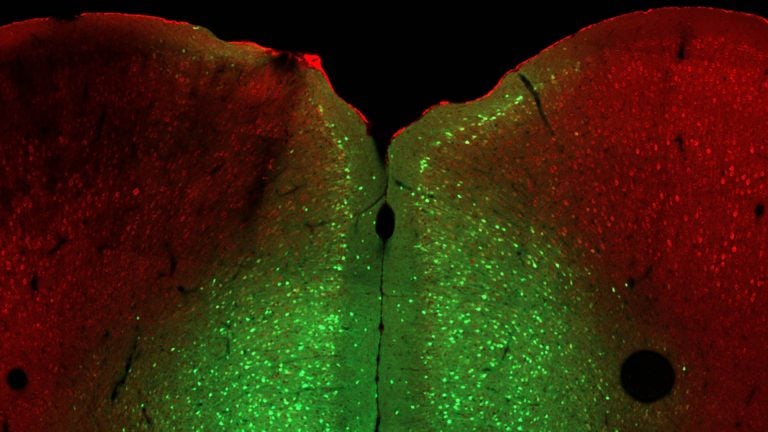 image of a slice of mouse brain
