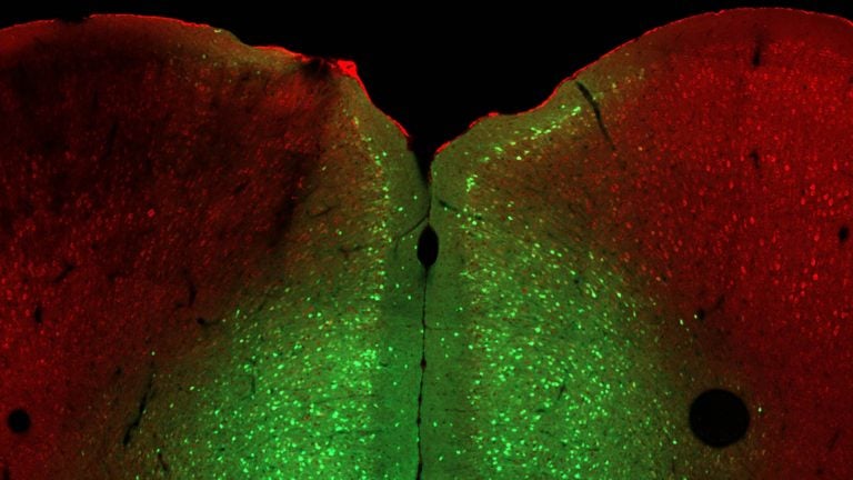 image of a slice of mouse brain