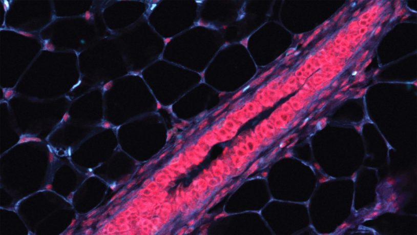 Cataloging breast cells to find cancer origins