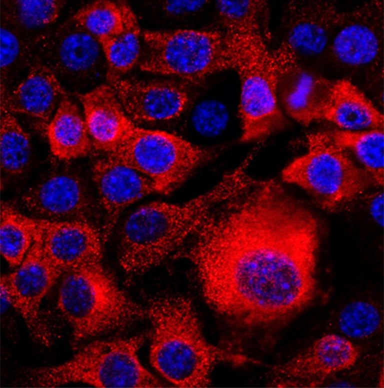 Image of Pancreatic Cancer Cells