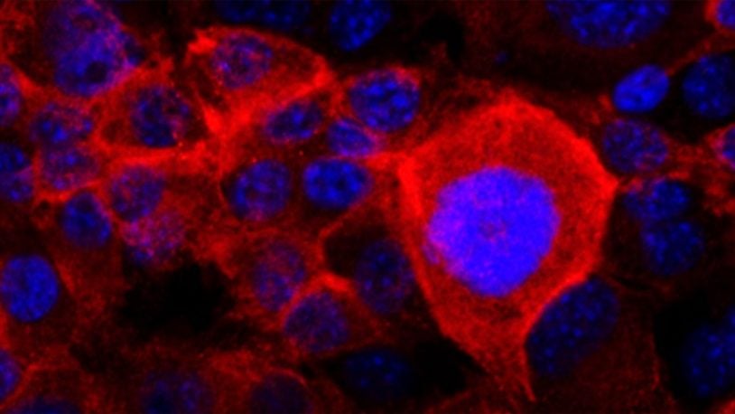 Image of Pancreatic Cancer Cells