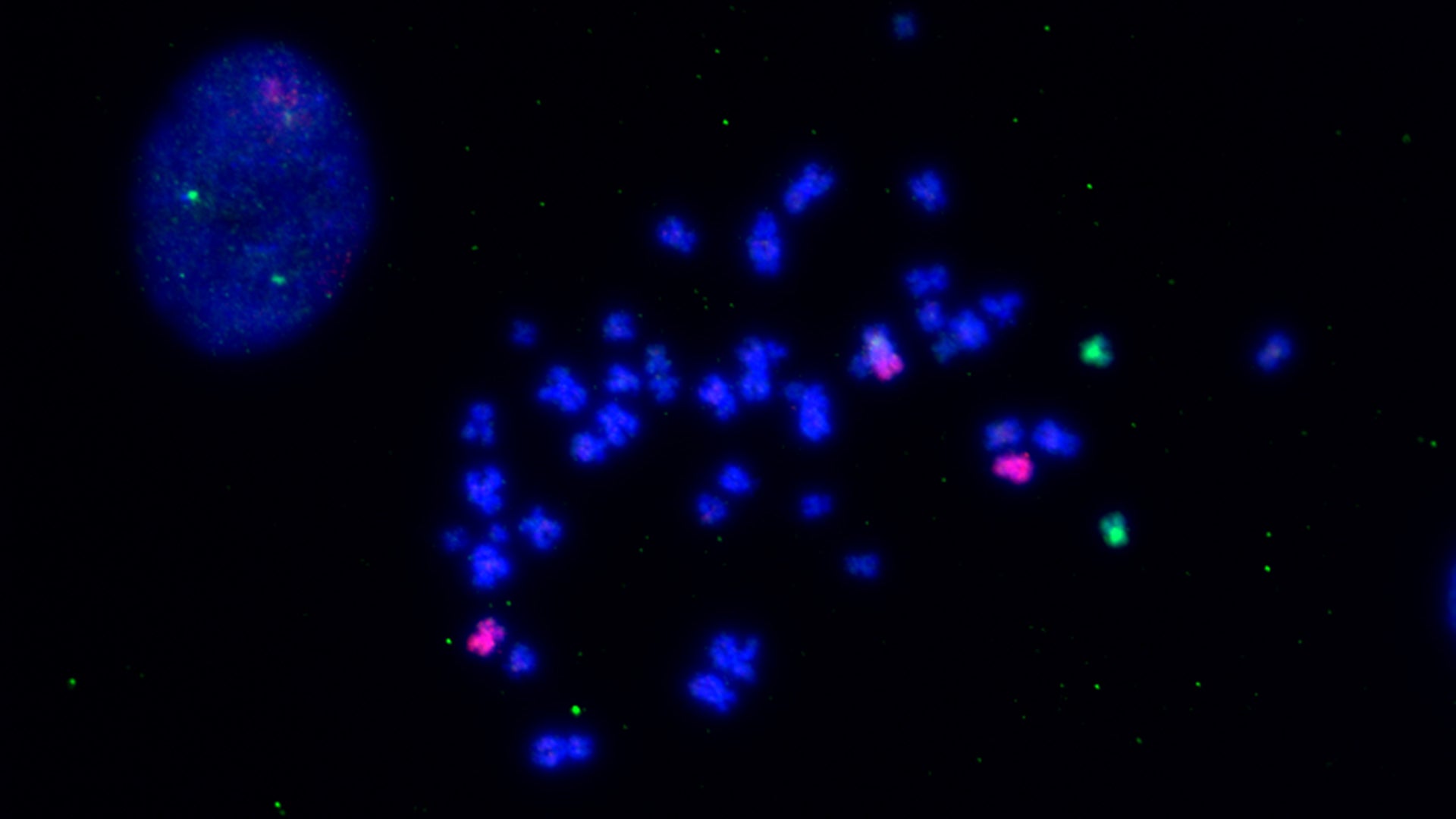 image of cancer cells with extra chromosomes