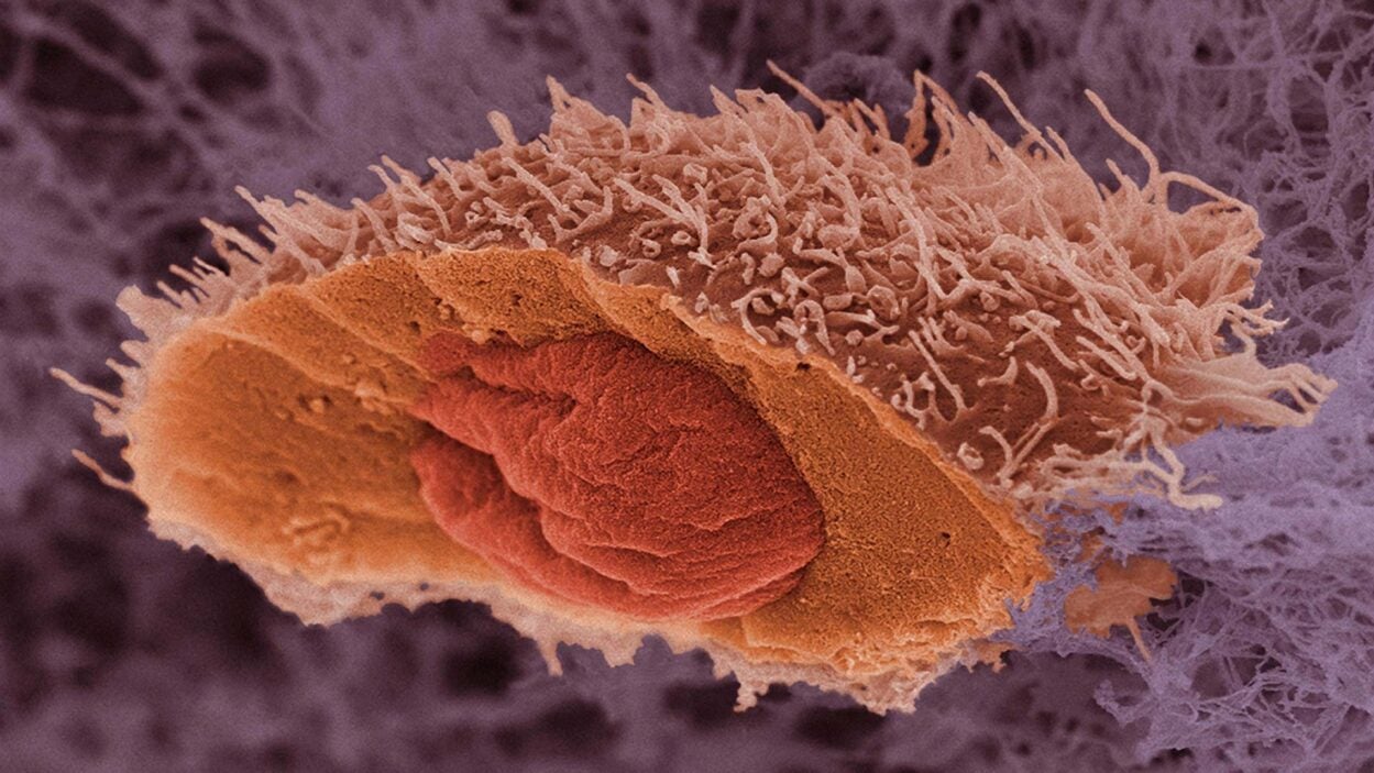 image of a skin cancer cell