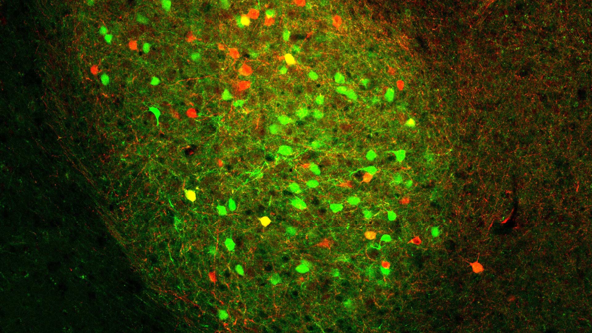 image of a mouse basolateral amygdala inside the brain