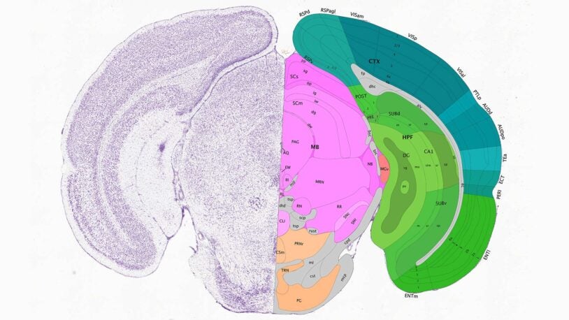 illustration of a slice of a mouse brain