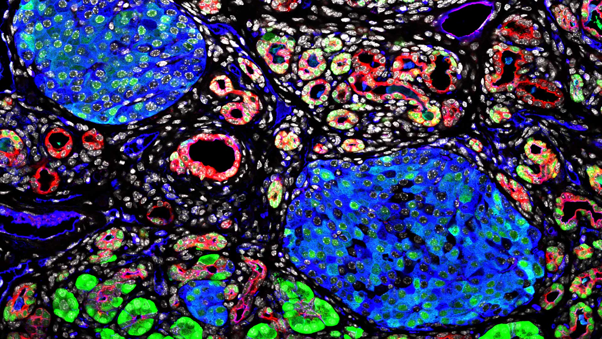 image of mouse pancreatic cancer
