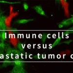 image of immune cells and metastatic tumor cells