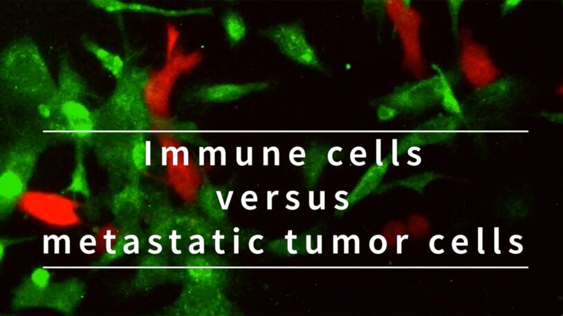 image of immune cells and metastatic tumor cells