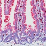 microscopic image of a normal mouse small intestine