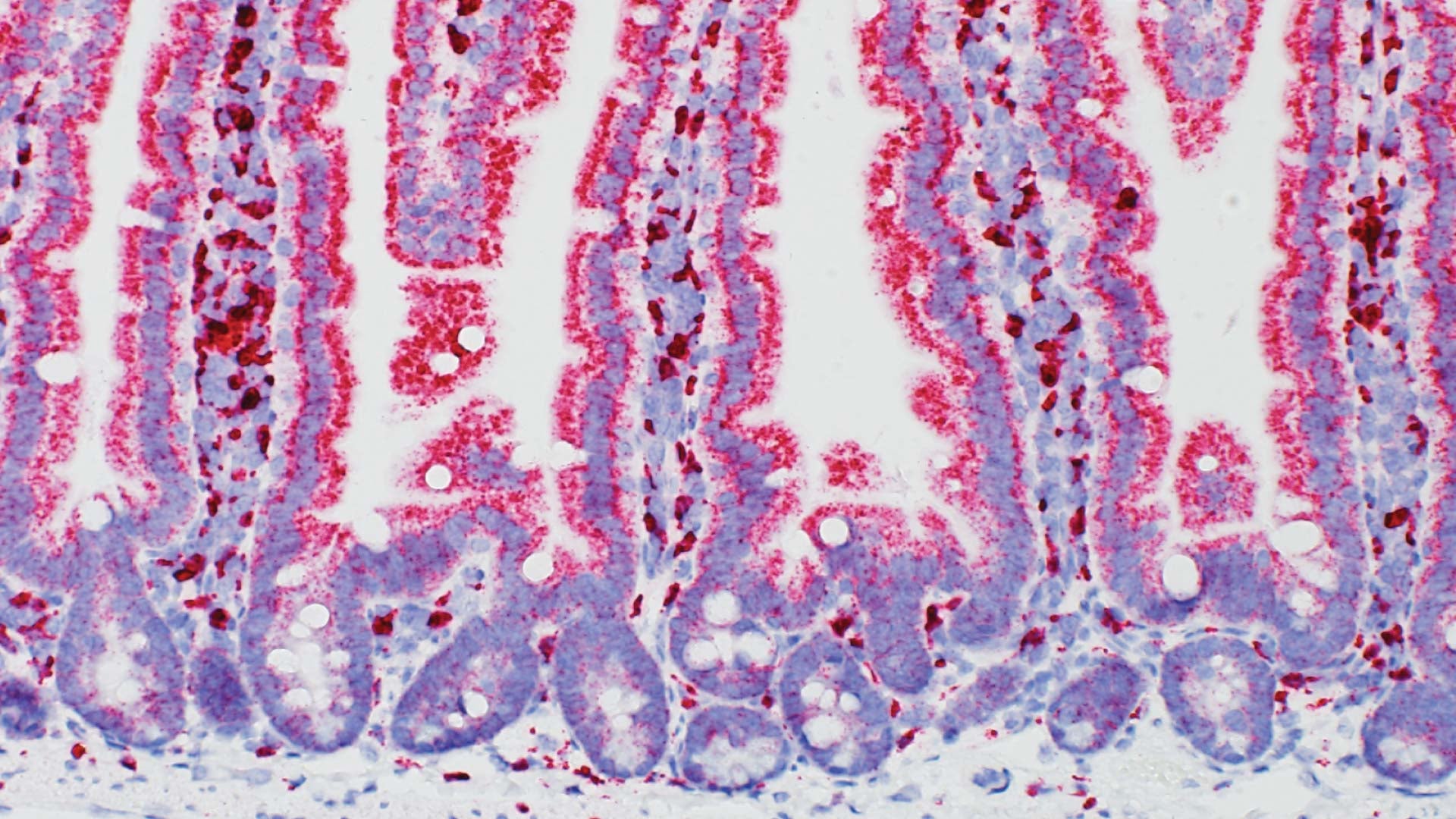 microscopic image of a normal mouse small intestine