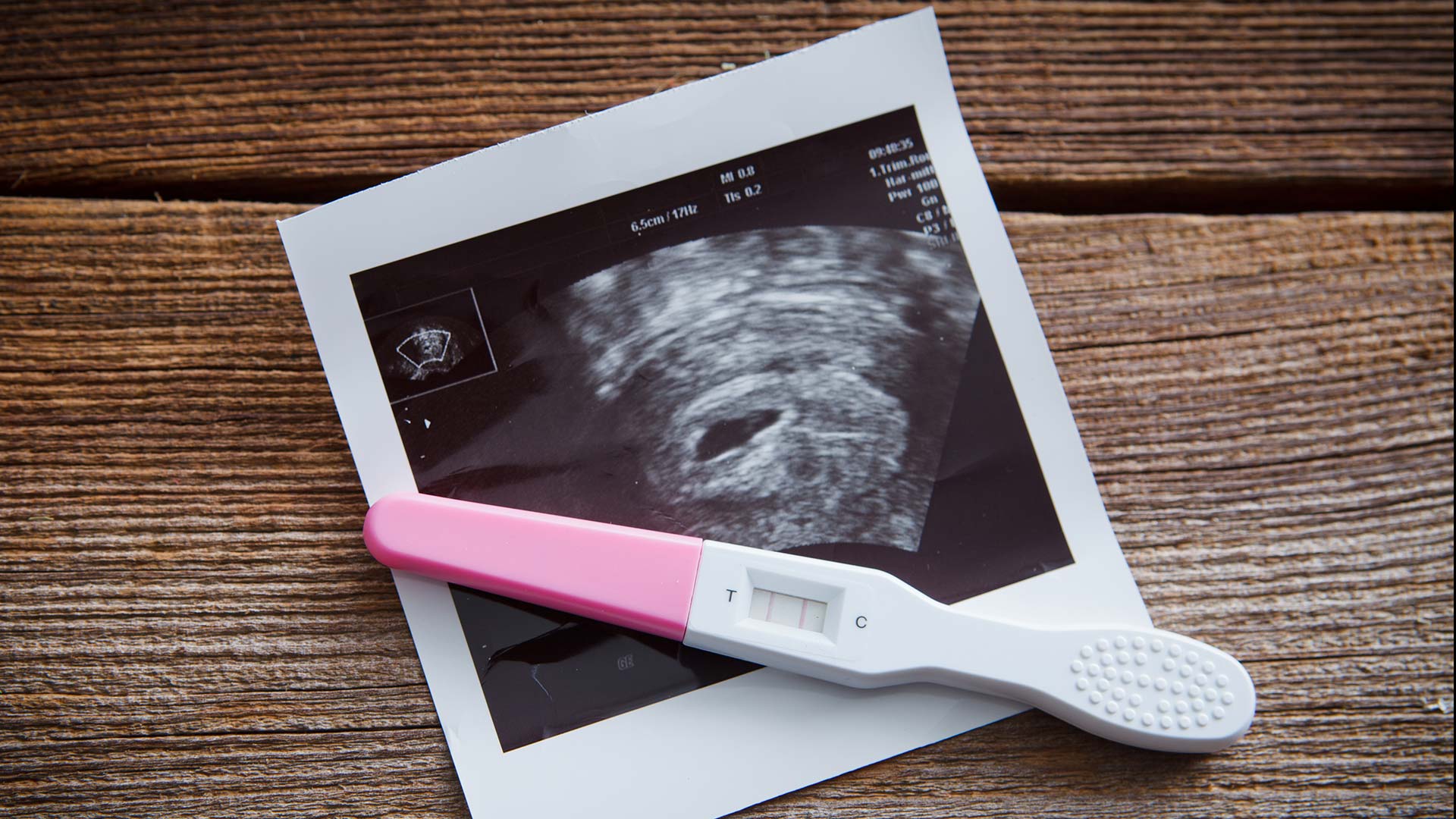 photo of a sonogram with pregnancy test stick