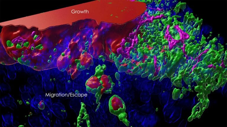 3D image of a mouse prostate