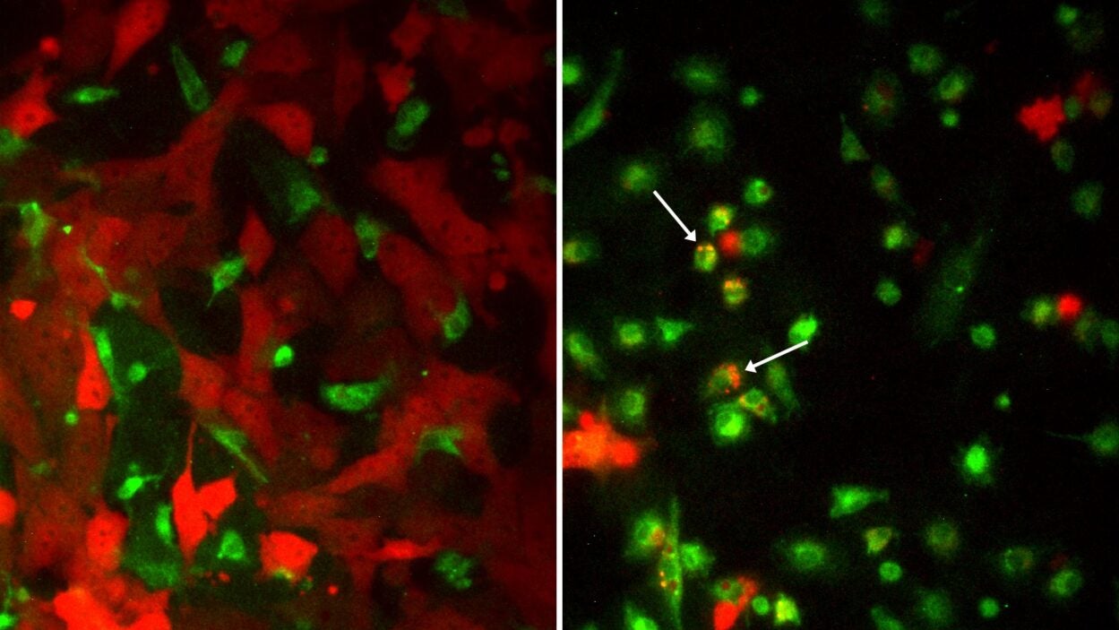 image of mouse breast tumor cells