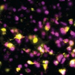 image of mouse nuerons