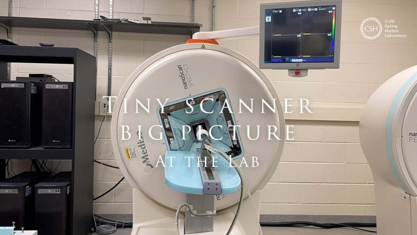 image from CT scanner video