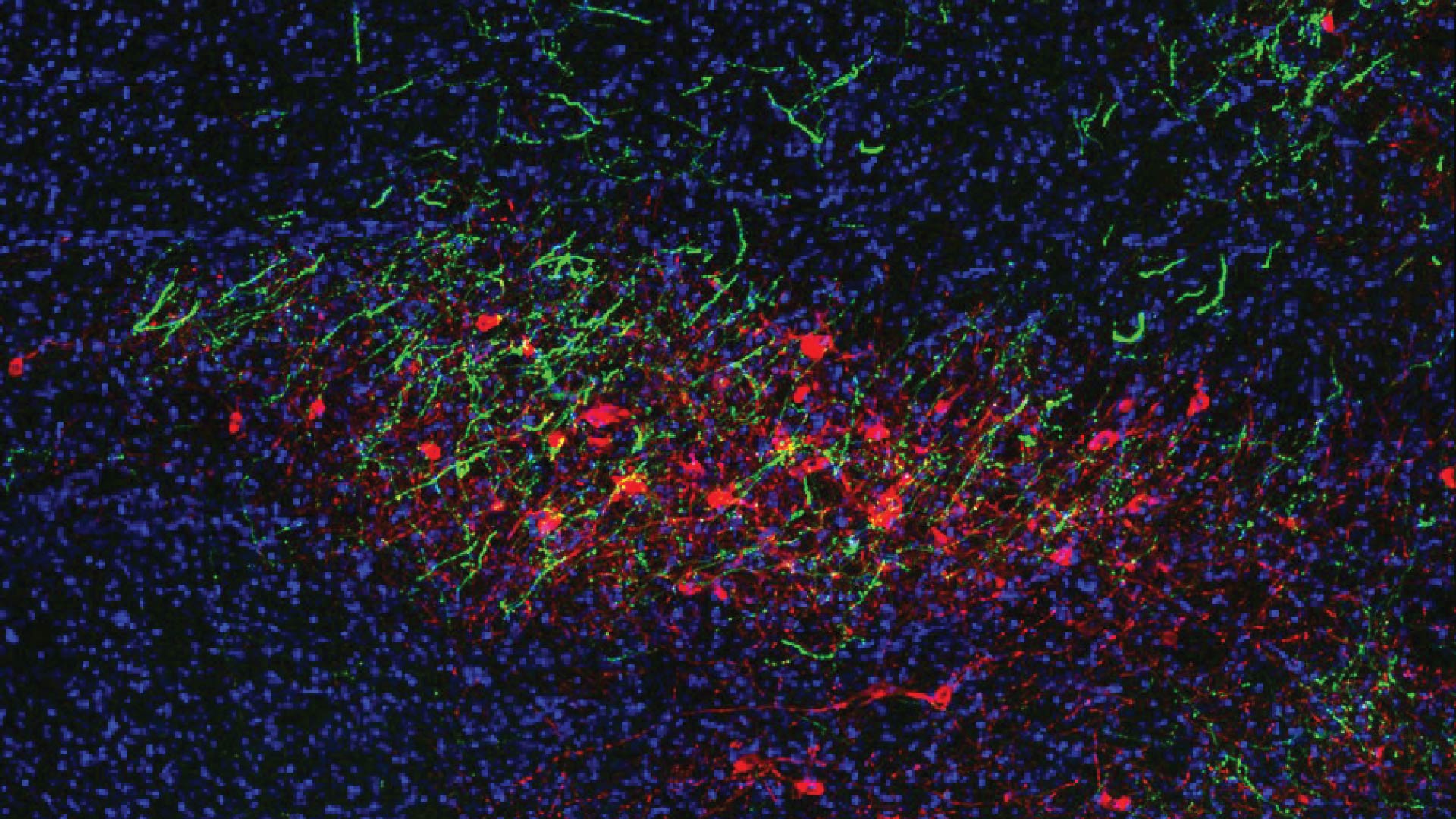 image of a neuron cluster in a mouse brain