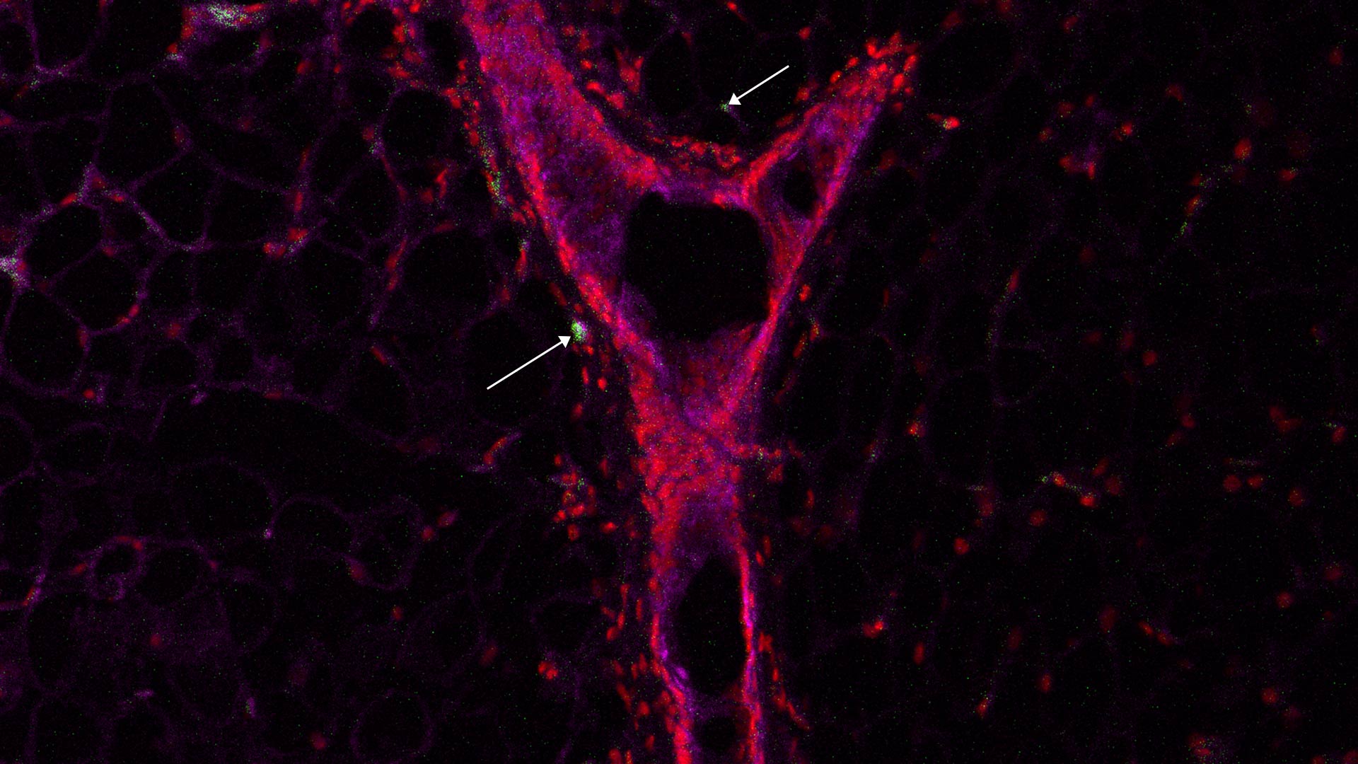 image of breast epithelial cells