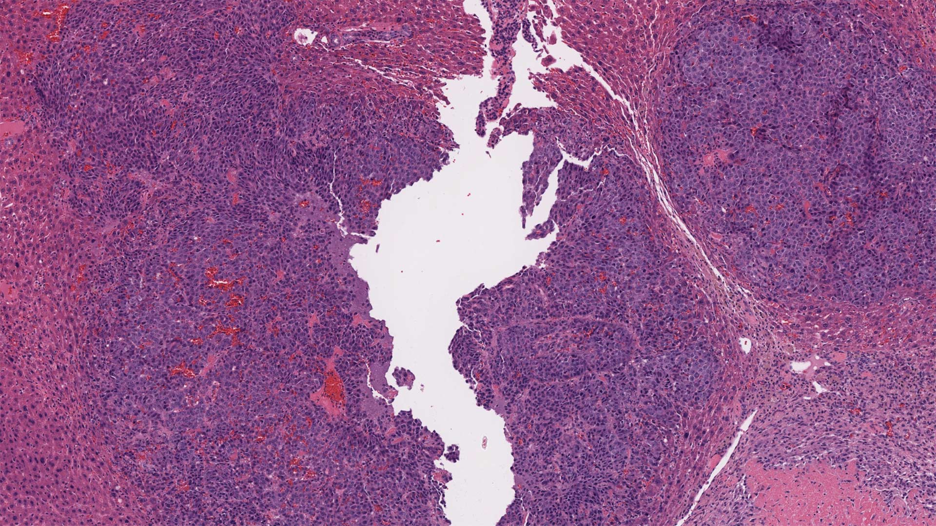 image of a mouse liver tissue with cancer tumor