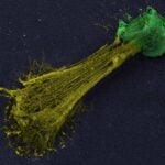 image of a neutrophil extracellular trap