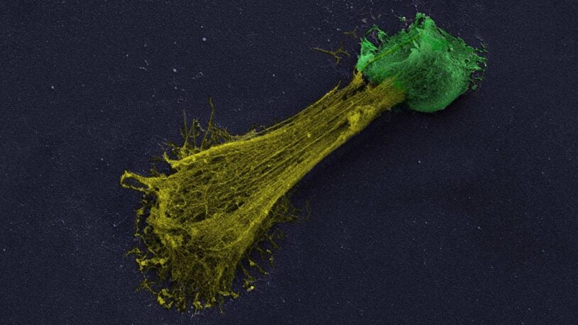 image of a neutrophil extracellular trap