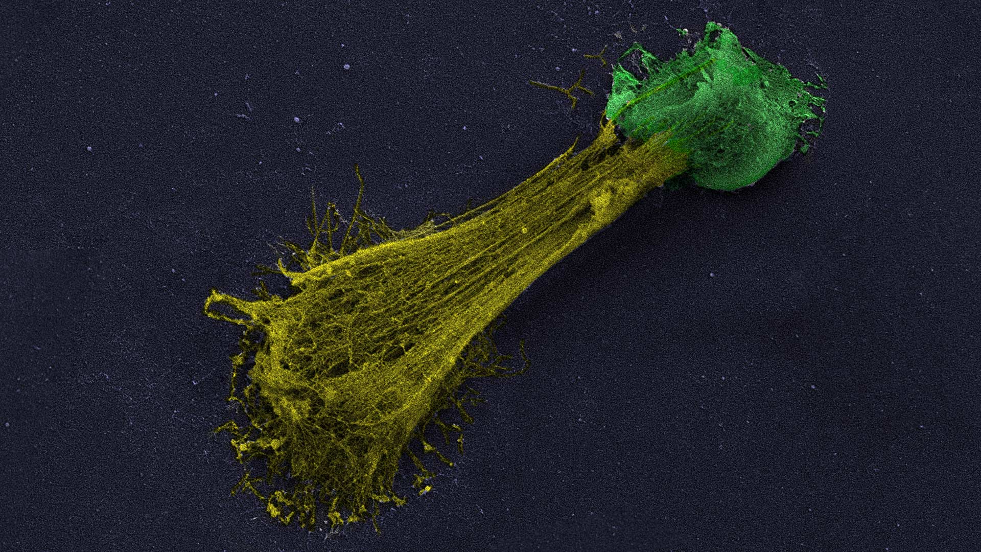 image of a neutrophil extracellular trap