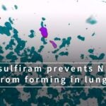 video still from disulfiram prevents NETs from forming in lungs video