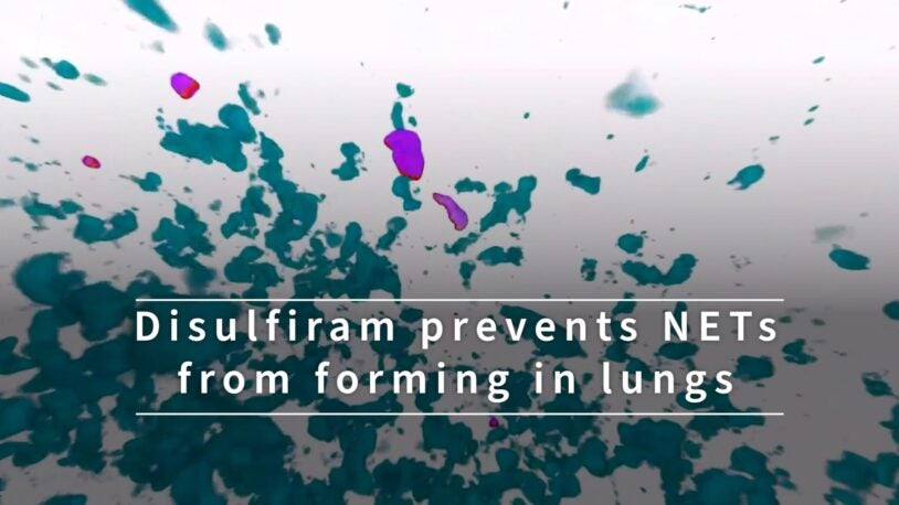 video still from disulfiram prevents NETs from forming in lungs video