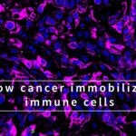 video still from how cancer immobilizes immune cells