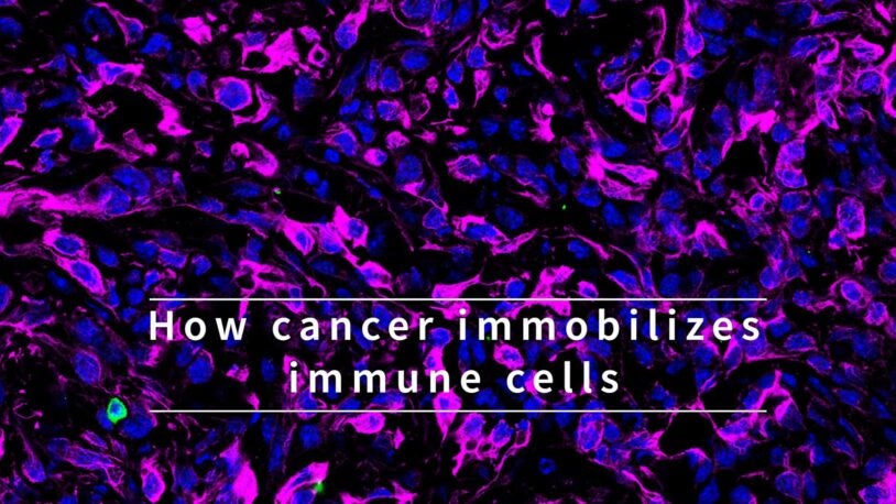 video still from how cancer immobilizes immune cells