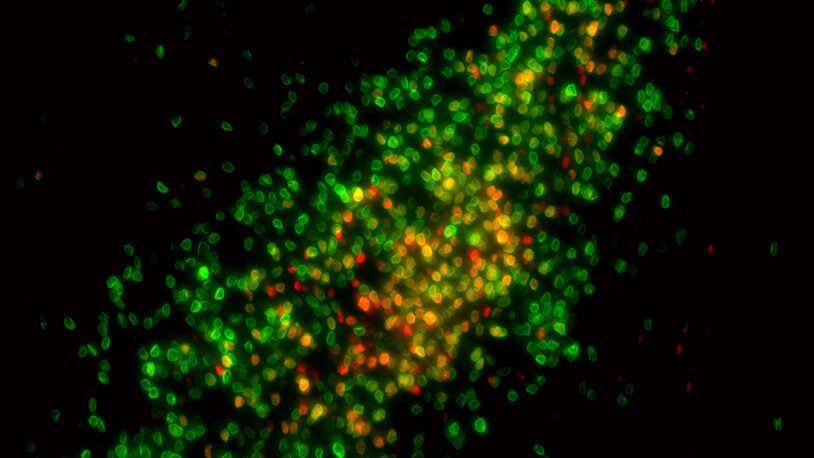 How hormones define brain sex differences