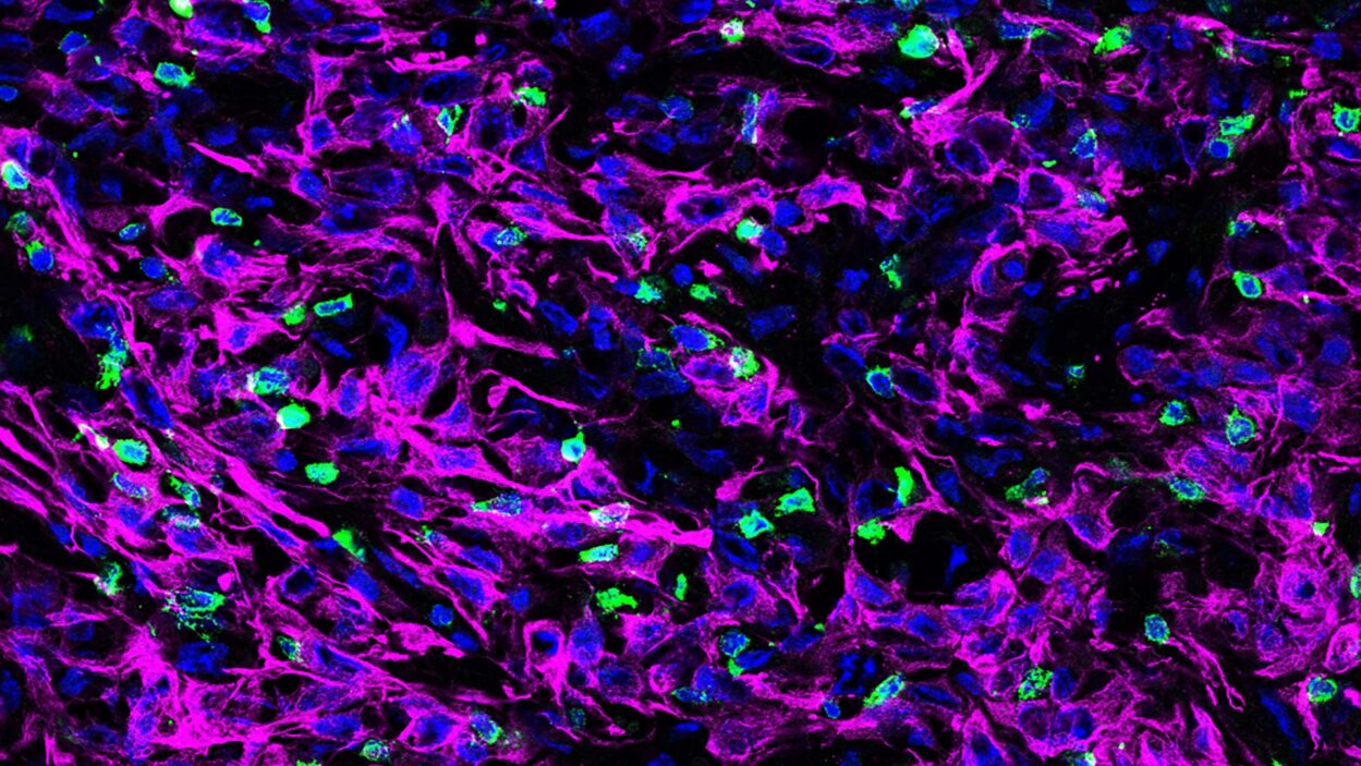 image of mouse pancreatic tissue