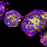 image of breast cancer organoids