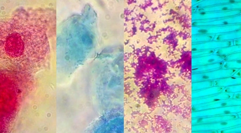 Saturday DNA A Look Inside Immunity image of various microscope images