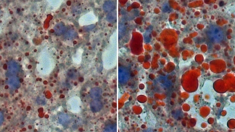 Image of comparison of mouse lipid droplets