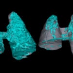 3D image of mouse lungs