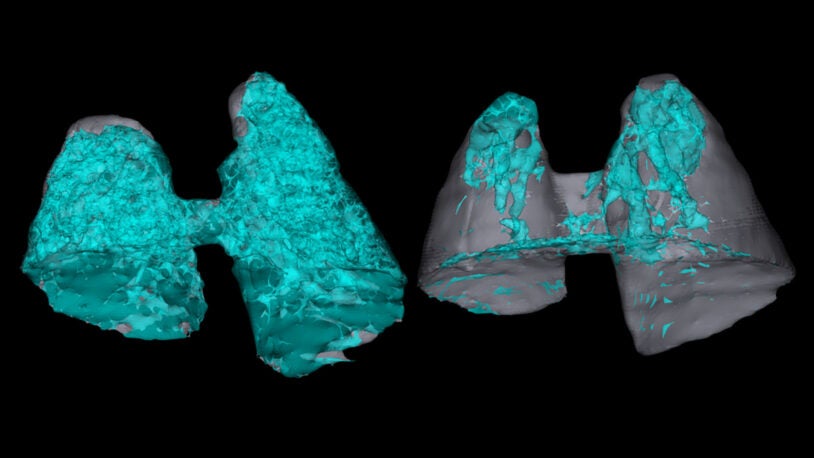 3D image of mouse lungs