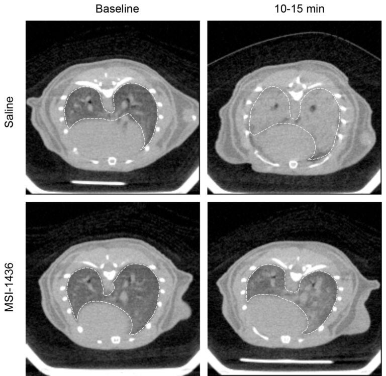 4 CT scans of mouse lungs