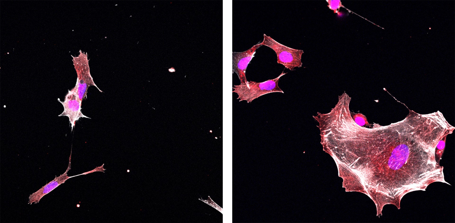 image of ETV6 connective tissue cells