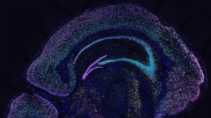 Image of BARseq2 brain-mapping showing RNA in genes of a mouse brain