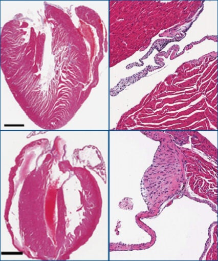 Image of heart valves and tissue
