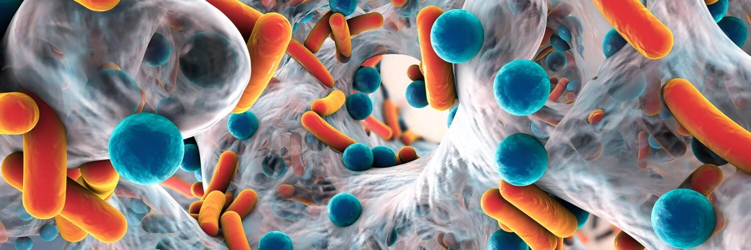 Image of MRSA bacteria