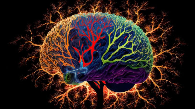 Image of Neurodivergent Brain